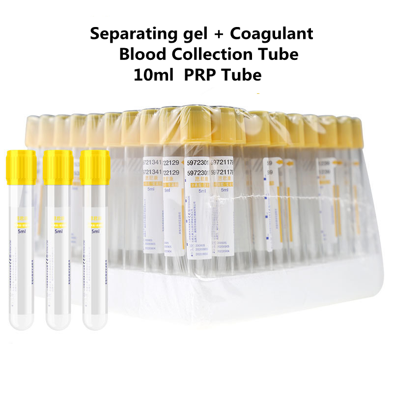 Medical Lab Blood Test - Одноразовый вакуумный пробирка для сбора крови,