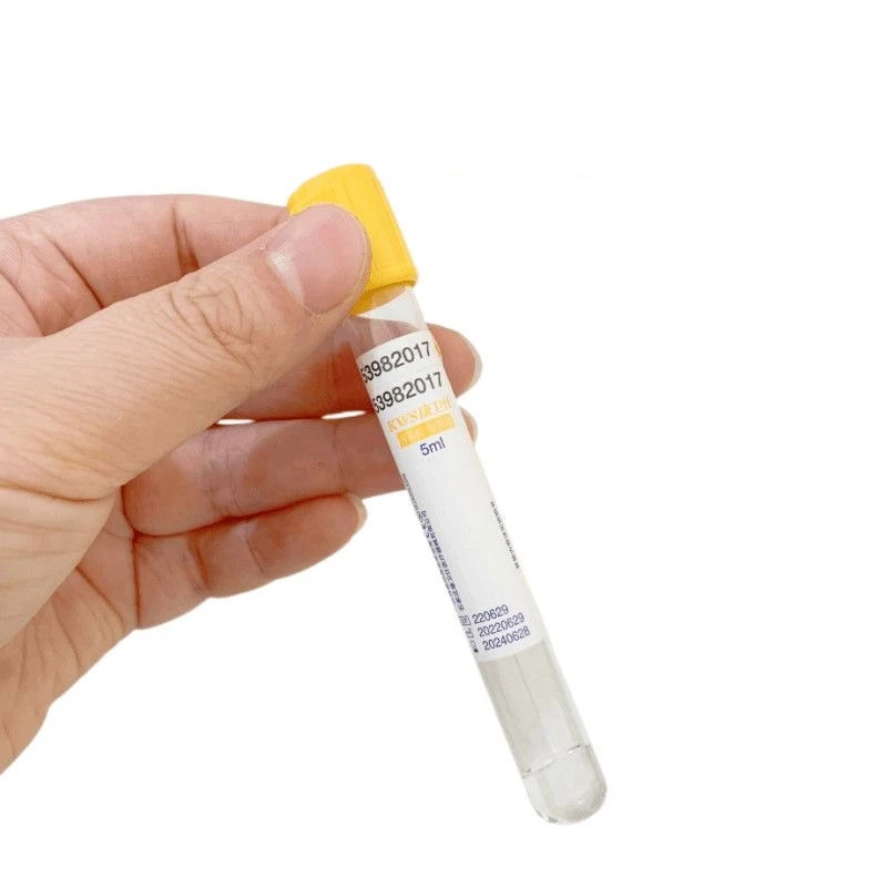 Одноразовый вакуумный пробирка – обзор и цена Medical Lab Blood Test